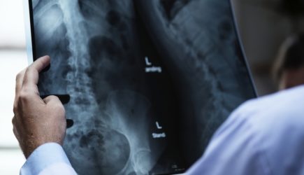 Врачи рассказали о заболеваниях, которые страшнее рака