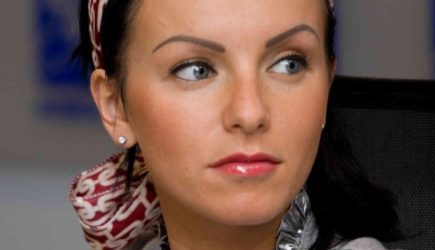 &#171;Франкенштейн&#187;: россияне не узнали перекроившую лицо Волкову из t.A.T.u.