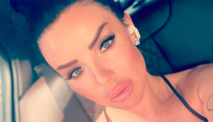 Экс-солистка «Тату» рассказала о сломавшем ей челюсть «нерусском мужчине»