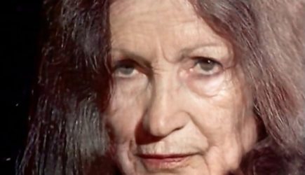 Стало известно, как бы выглядели Пугачева и Ротару без «пластики»