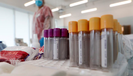 Вирусолог назвал группы населения с плохой выработкой антител к COVID-19