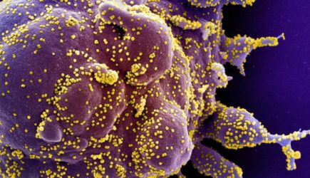 Вашингтон назвал &#171;самую достоверную&#187; версию происхождения коронавируса