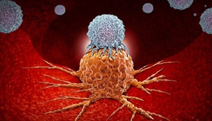 Онколог назвал самый вредный продукт: а мы едим его каждый день