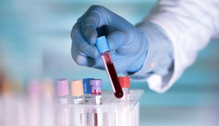 Человек &#8212; инкубатор для ковида: новое открытие ученых