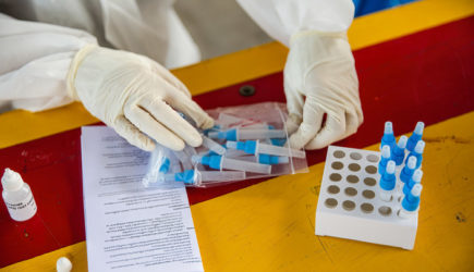 COVID сменил тактику: Жар и потеря обоняния уже «не актуальны»