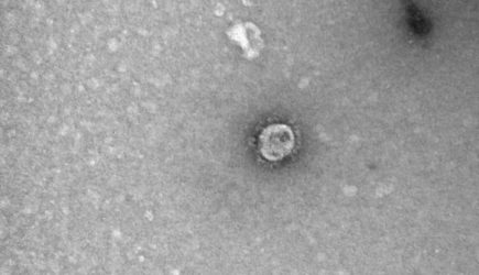 Летучие мыши из ЮАР могут стать источником нового опасного для человека коронавируса