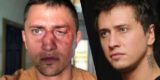 Прилучный рассказал, как у&nbsp;него после драки онемела левая часть лица