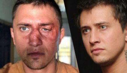 Прилучный рассказал, как у&nbsp;него после драки онемела левая часть лица