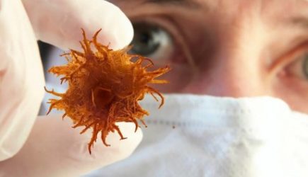 Медики выяснили, почему мужчины болеют раком чаще женщин