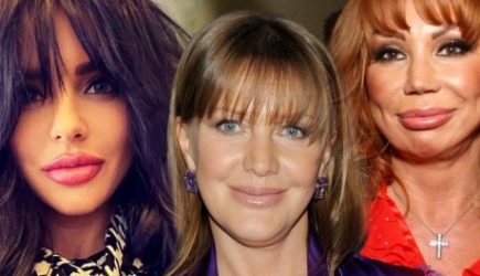 Без слез не взглянешь: 3 знаменитости, которые зря &laquo;накачали&raquo; губы