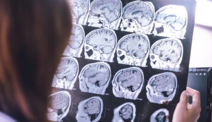 Назван способ отличить деменцию на ранней стадии от забывчивости