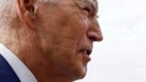 Врач объяснила появление необычных следов на лице Байдена