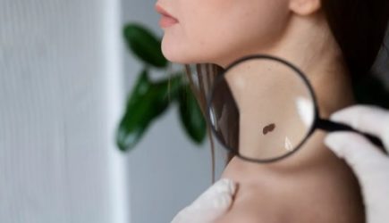 Увидели &mdash; бегом к врачу: вот какие родинки на теле скажут об угрозе для жизни