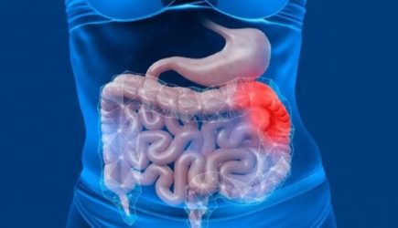 Кишечник станет &laquo;швейцарскими часами&raquo;: вот что нужно есть после 30 лет