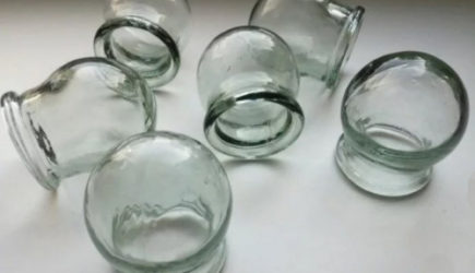 Почему в СССР больным прописывали &laquo;банки&raquo;, а теперь их не ставят: польза или вред