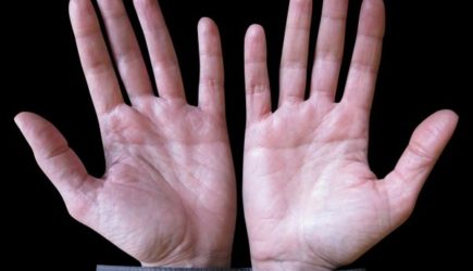 Хироманты в шоке: люди с этой буквой на руке особенные