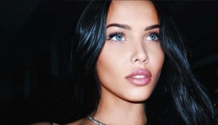 Модель Решетова рассказала, почему не могла смотреть на свое лицо