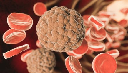 &#171;Чистка сосудов&#187; без таблеток: эксперт назвала 10 продуктов, которые снижают &#171;плохой&#187; холестерин