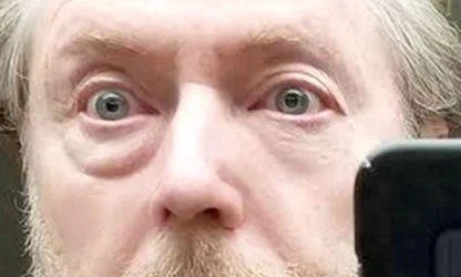 Как мужчине убрать мешки под глазами? Это поможет!