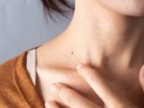Родинки, шепчущие о беде: знаки тела, требующие внимания