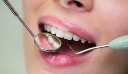 Японские ученые раскрыли главную опасность неправильного прикуса