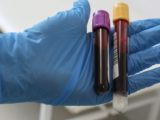 Неизвестный вирус в Бурунди: эпидемиолог оценил риски новой вспышки
